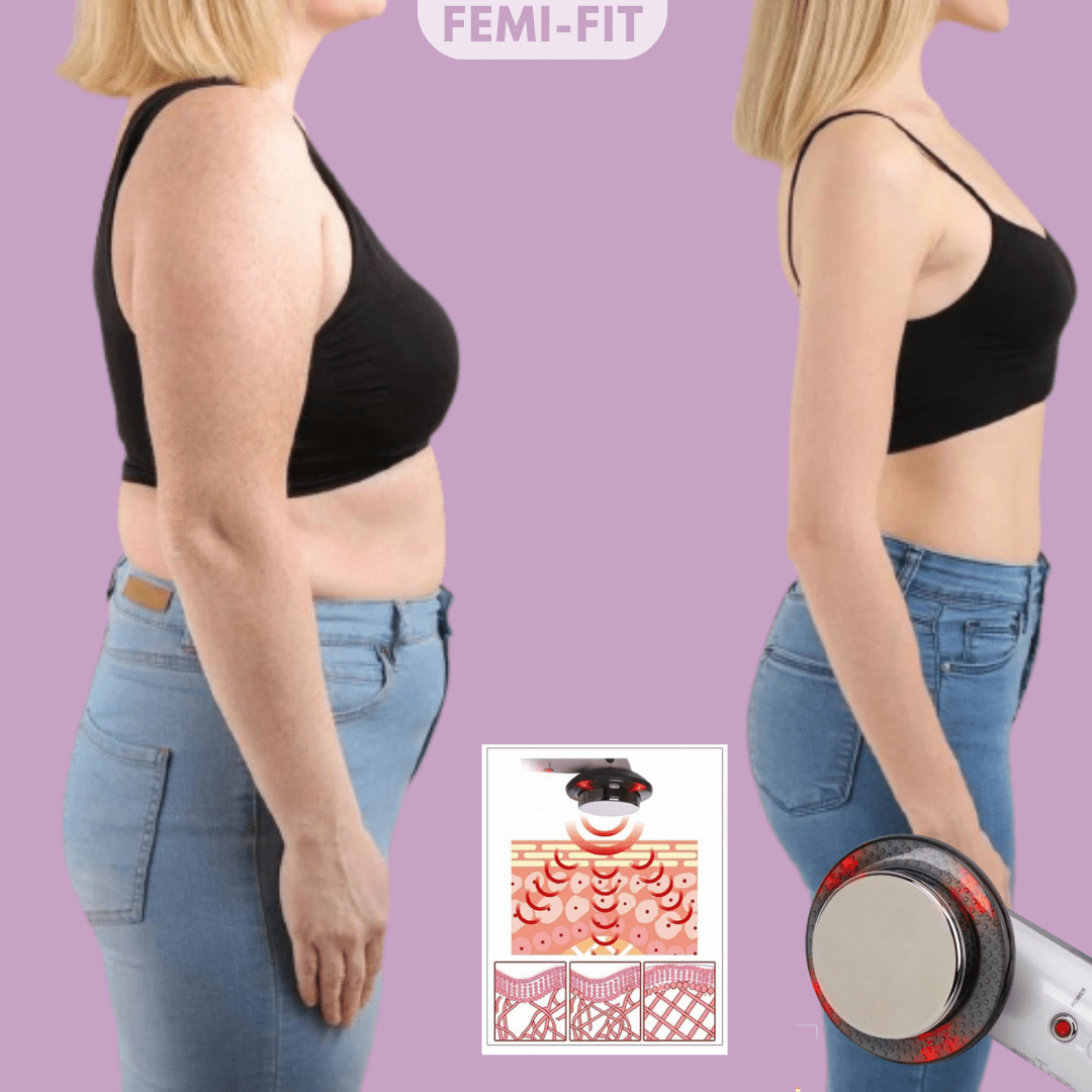 Slimshape- 3-in-1 cellulite and fat burner with EMS, ultrasound and infrared light-1