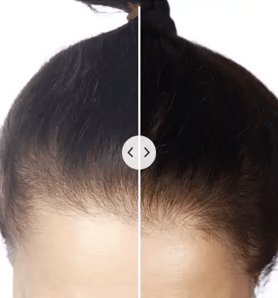  Multifunctional hair comb with light therapy-5-in-1 hair comb for healthy hair-5