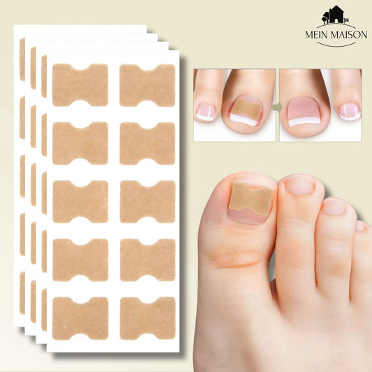 Fixerail - gentle nail correction against ingrown nails & pain 0