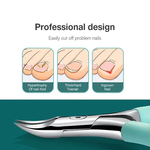 SureClip – Ergonomické kliešte na nechty na nohy s ochranou proti striekaniu