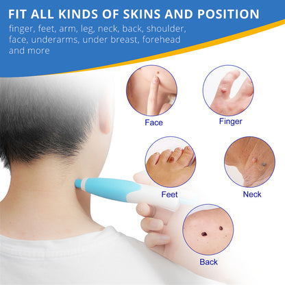 Dermoclear – Skin Tag & Wart Remover for Painless At-Home Treatment