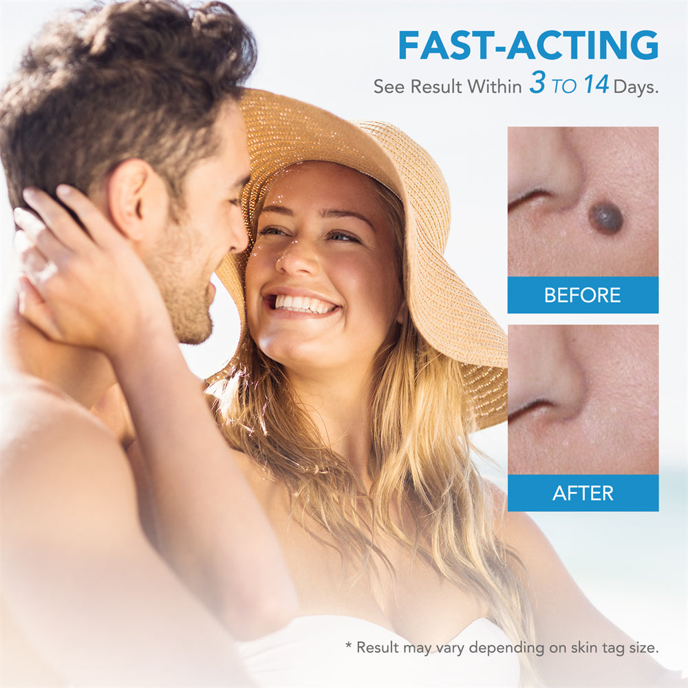 Dermoclear – Skin Tag & Wart Remover for Painless At-Home Treatment