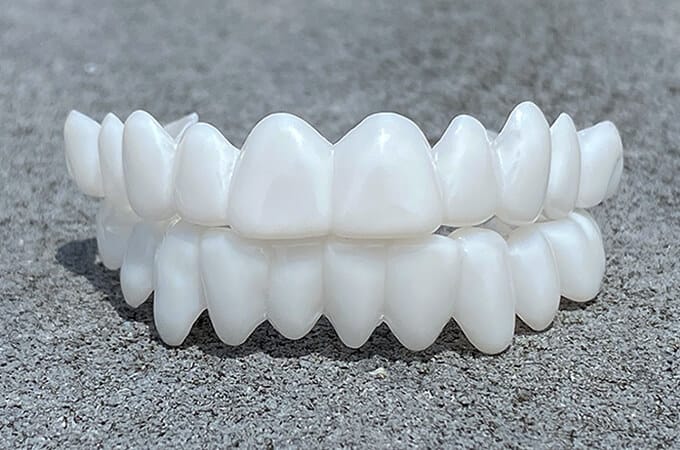 SmileFlex - prótesis con lentes dentales blancas