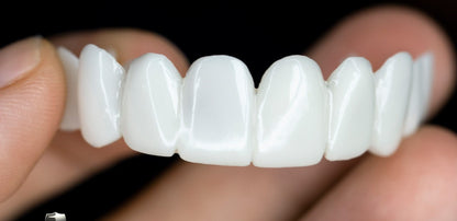 SmileFlex - prótesis con lentes dentales blancas