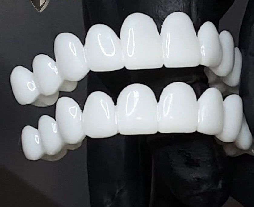 SmileFlex - prótesis con lentes dentales blancas
