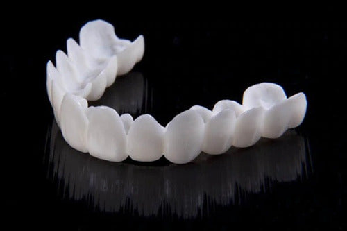 SmileFlex - prótesis con lentes dentales blancas