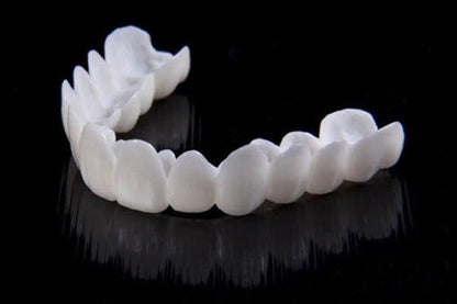 SmileFlex - prótesis con lentes dentales blancas