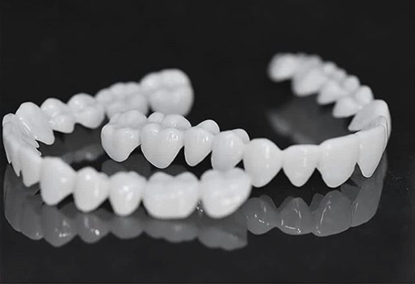 SmileFlex - prótesis con lentes dentales blancas