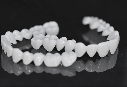 SmileFlex - prótesis con lentes dentales blancas