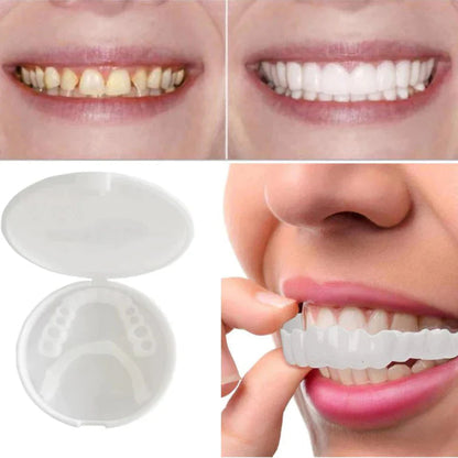 SnapFit Dental Restoration – Perfect Smile Without Dentist Visits