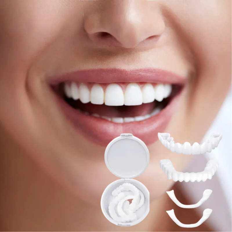 Restauration dentaire SnapFit - Un sourire parfait sans visite chez le dentiste