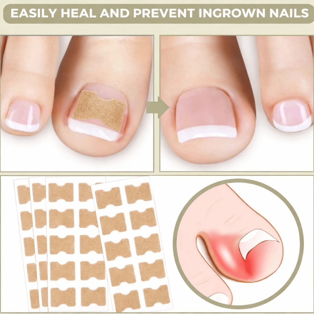 ALIGNSTRIP – Pijnloze Nagelcorrectiestrips voor Ingegroeide en Vervormde Nagels