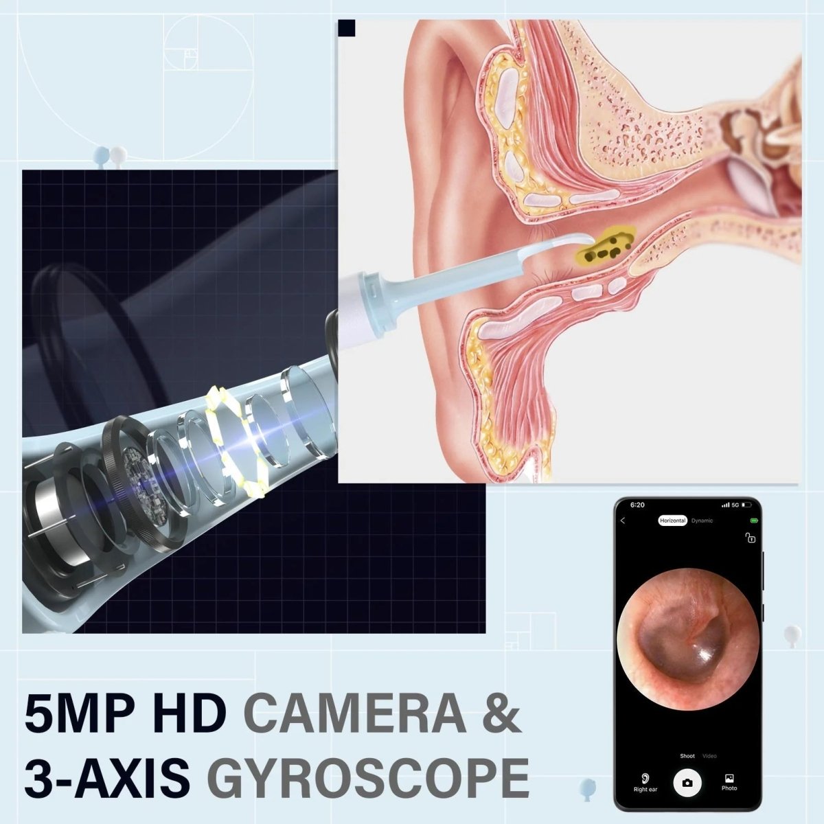 AURIVIEW – Limpiador de oídos inteligente con cámara HD