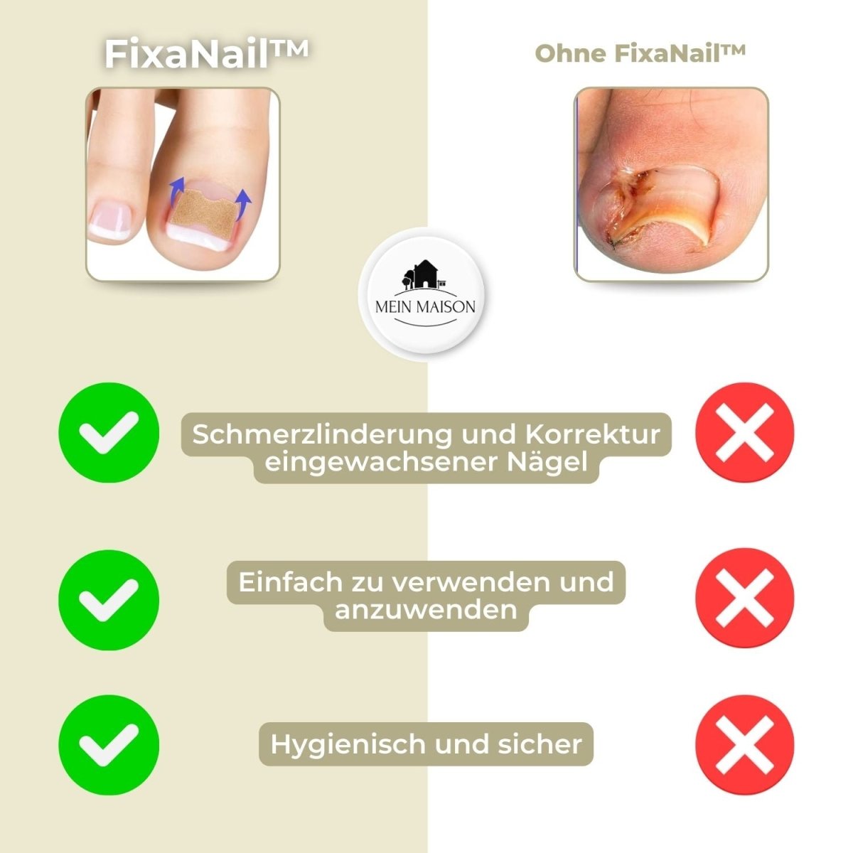 Fixerail - gentle nail correction against ingrown nails & pain 5