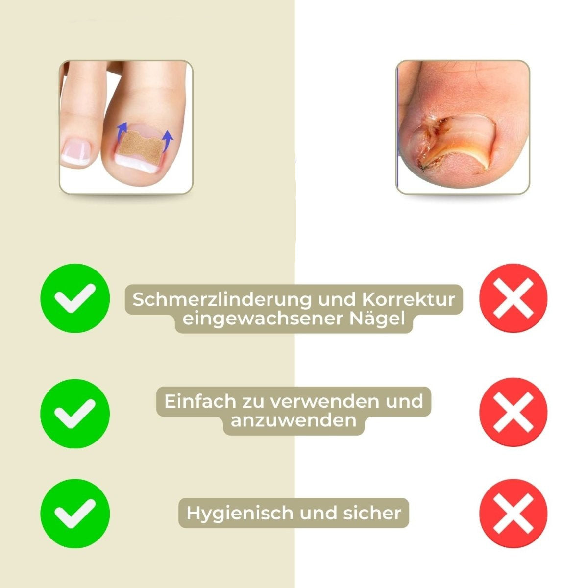 Fixerail - gentle nail correction against ingrown nails & pain 5