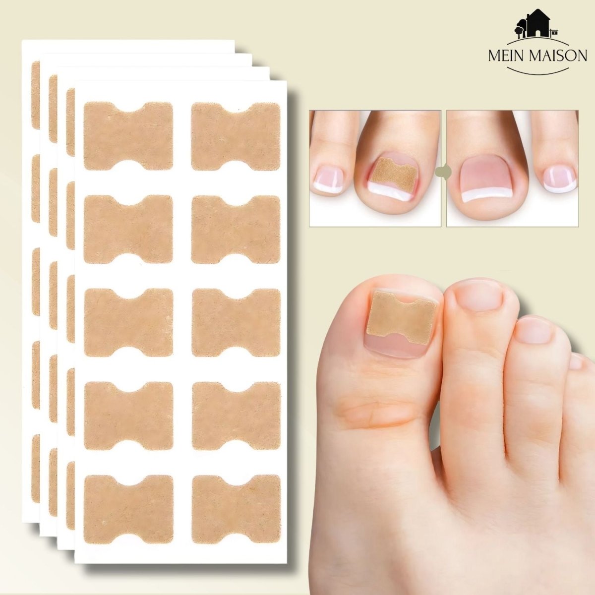 Fixerail - gentle nail correction against ingrown nails & pain 0