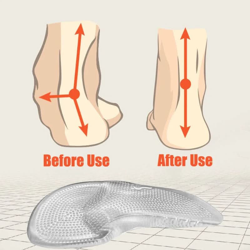 ComfortStep - Silicone Gel Orthopedic Insoles for Pain Relief and Support 4