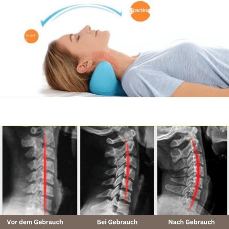 Nekra – Almofada de Massagem Ergonómica para o Pescoço para Conforto e Relaxamento