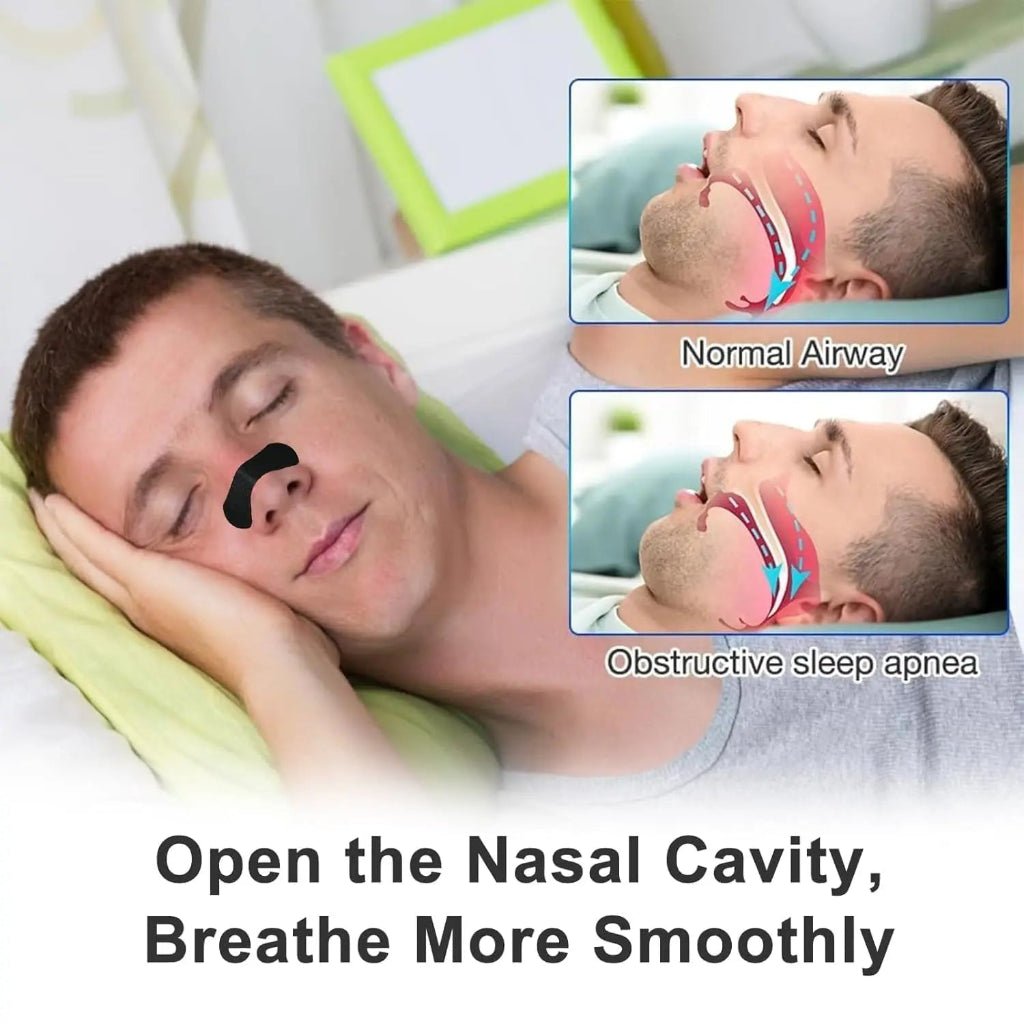 NOSEFLOW ACTIVEBREATHE – Nasal Breathing Strips for Enhanced Airflow 1