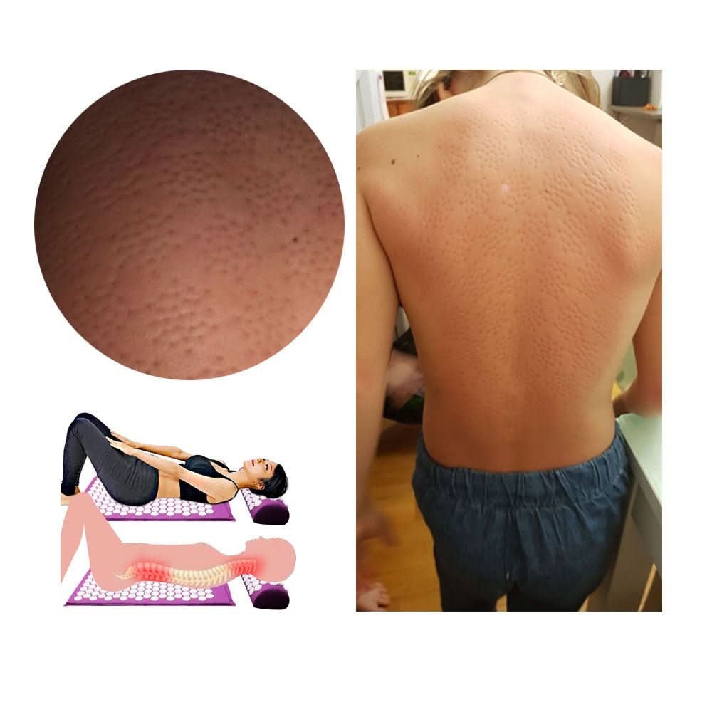  Relaxpress yoga mat with acupressure points for pain relief and relaxation-6