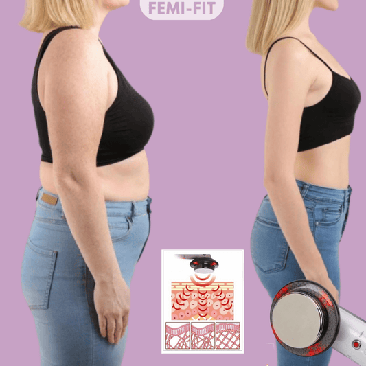  Slimshape- 3-in-1 cellulite and fat burner with EMS, ultrasound and infrared light-1