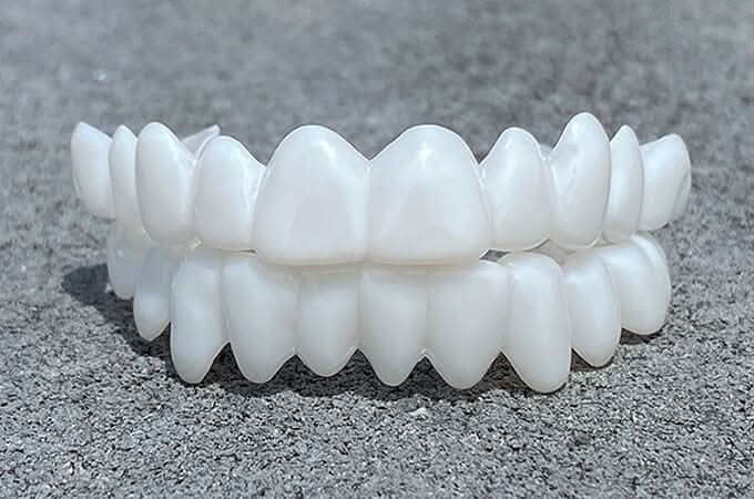 FLEXIDENT – Facette dentaire à l'apparence naturelle pour une confiance au quotidien