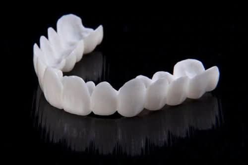 FLEXIDENT – Facette dentaire à l'apparence naturelle pour une confiance au quotidien