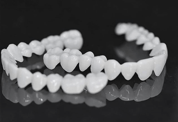SmileFlex – natuurlijk ogende tandfineer voor dagelijks gebruik