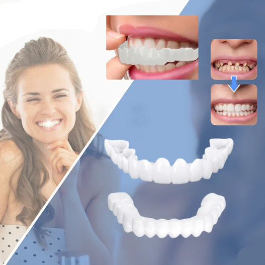Restauration dentaire SnapFit - Un sourire parfait sans visite chez le dentiste